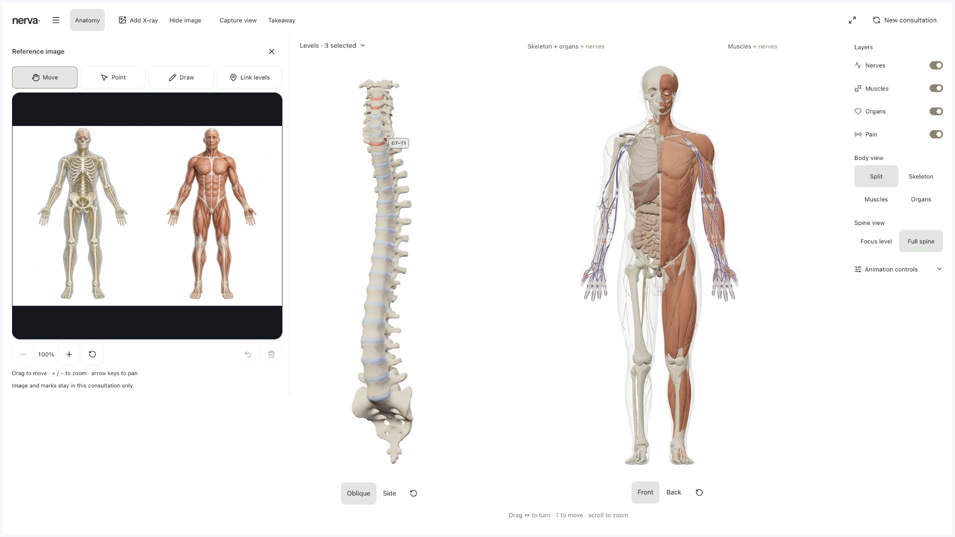 An anatomy reference image alongside the current Body in View spine and split-body view.
